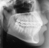 Radiologia Odontológica em Muriaé